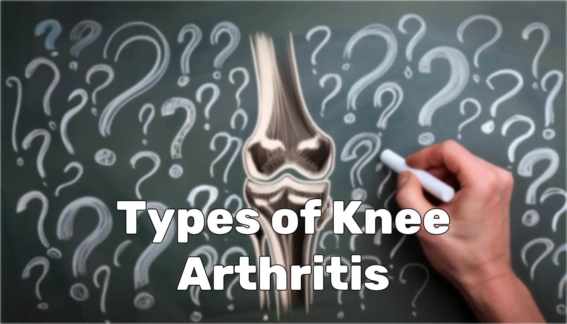 blog what does knee arthritis feel like 03