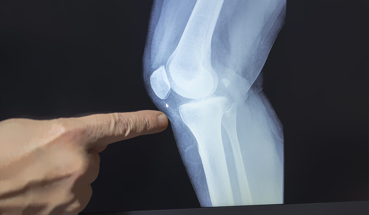 deep knee pain 4 deep knee pain 4