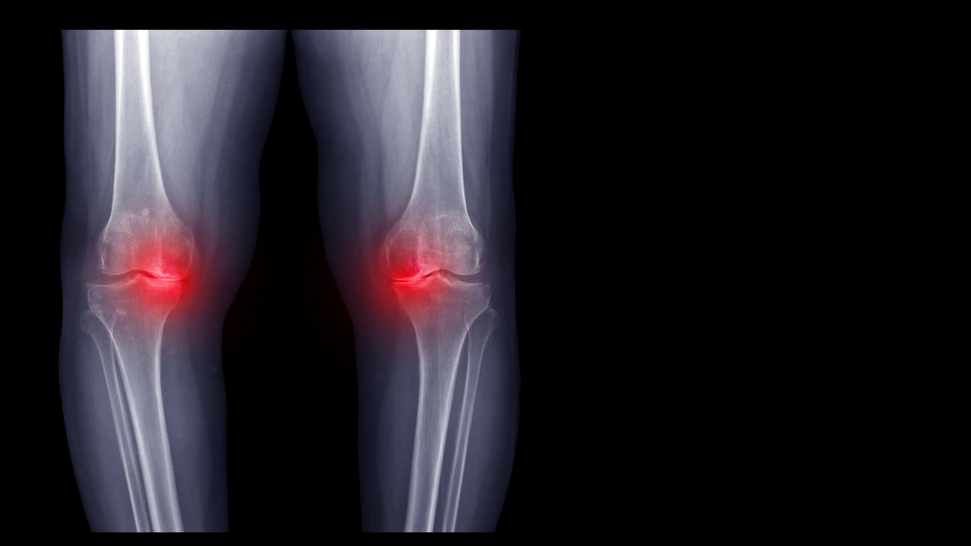 Inner Knee Pain Here Are Some Of The